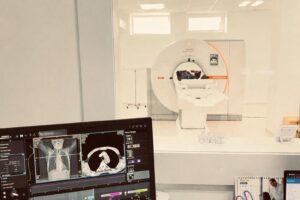 Lux-Ro a adus CT-ul care "fotografiază" inima. Angio-CT coronarian, disponibil din aprilie pe bază de recomandare de la cardiolog